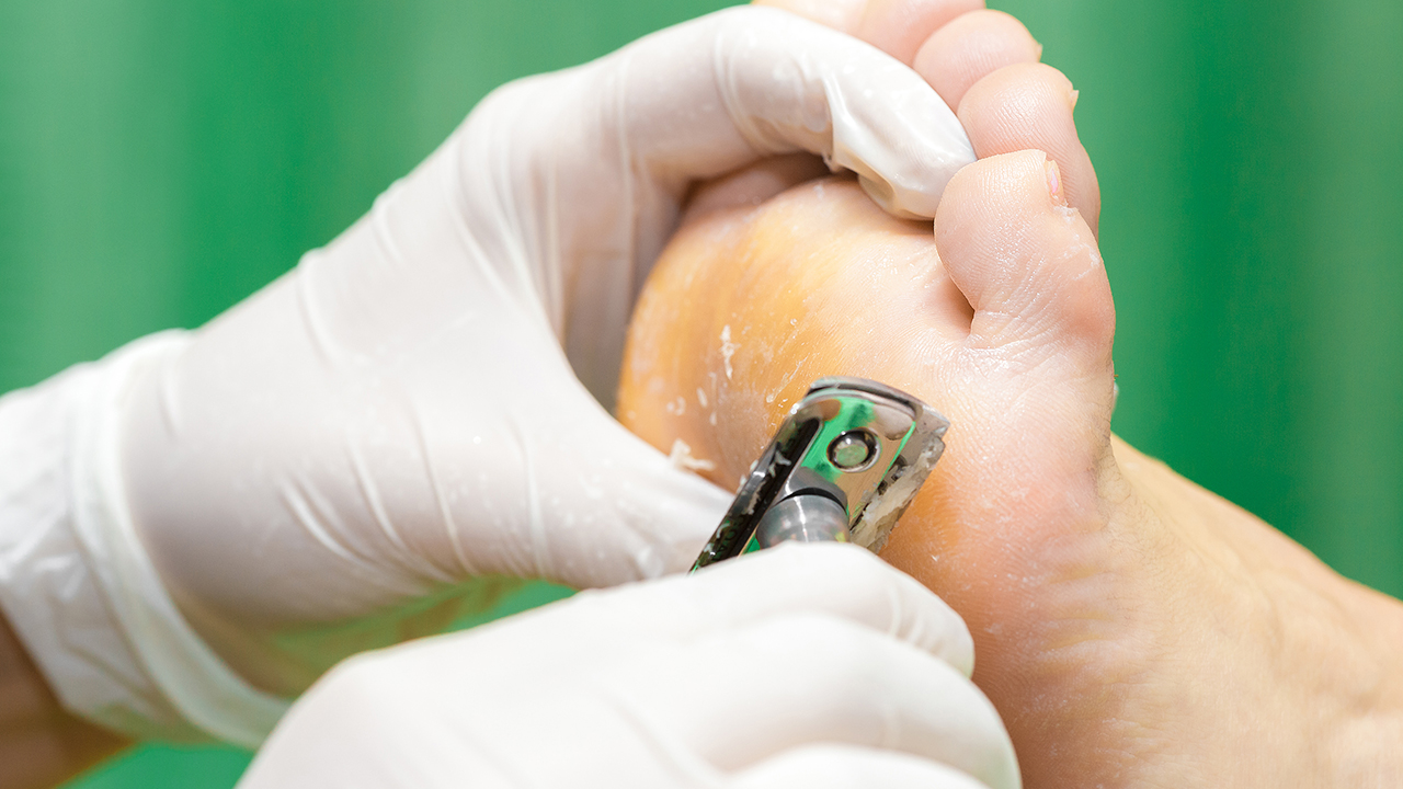 繡雞眼用什么線好了