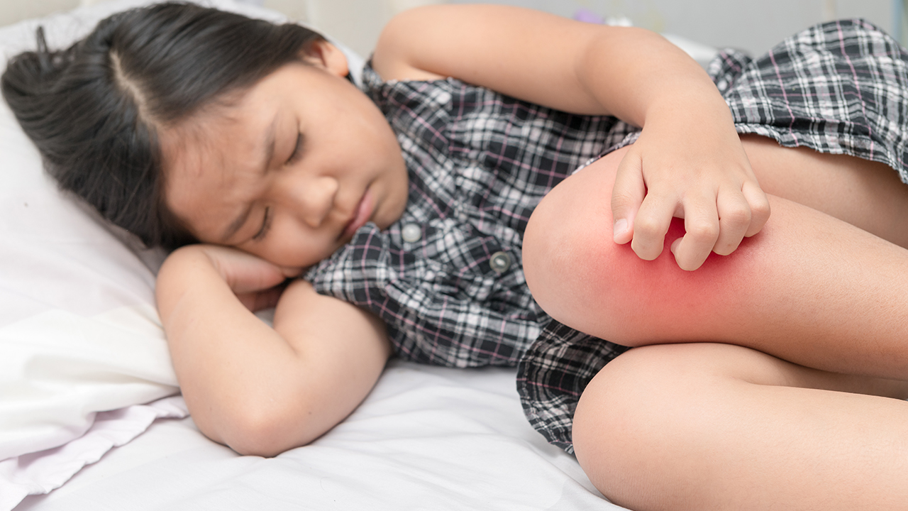 有類風(fēng)濕長吃的非甾體藥嗎