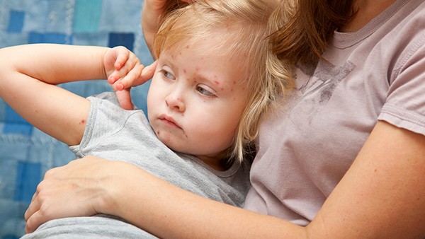 盆腔淤血綜合癥癥狀，帶你了解真實(shí)情況