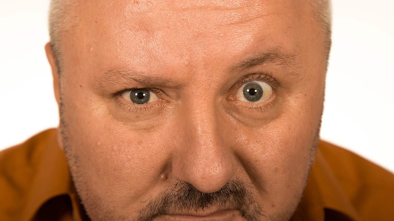 檢查結(jié)果是右眼慢性淚囊炎