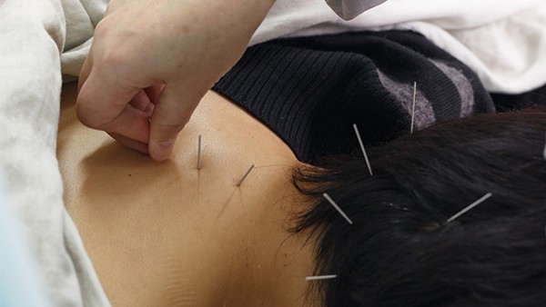 嚴(yán)重的類風(fēng)濕怎么治療方法