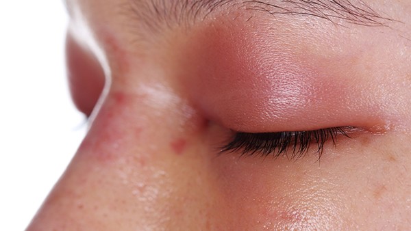 揭露光子嫩膚的過程  光子嫩膚的作用