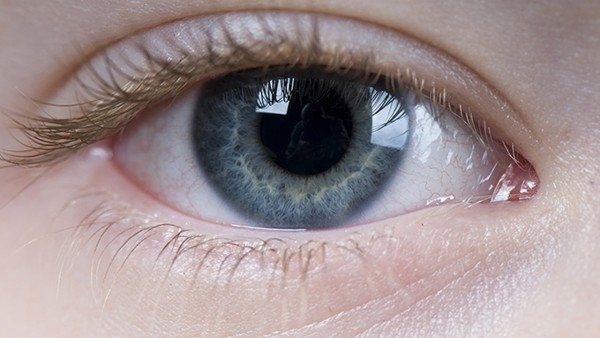 眼鏡造成的內(nèi)斜視怎么調(diào)整