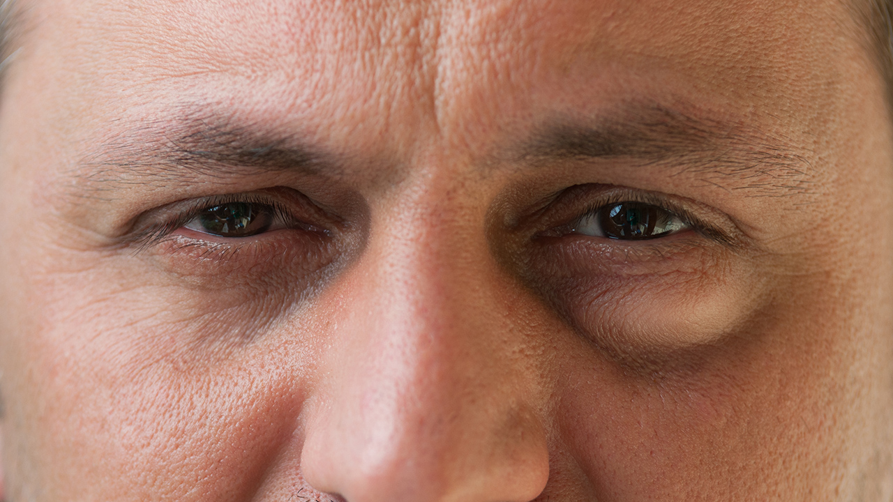 急性淚囊炎多久能好