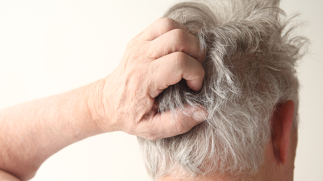 頸椎間盤突出導(dǎo)致大量脫發(fā)