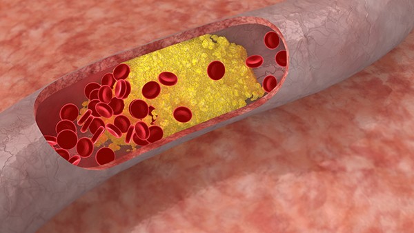 增生性貧血紅細(xì)胞形態(tài)特點(diǎn)