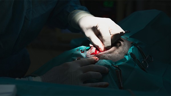 做近視手術(shù)內(nèi)斜視會(huì)恢復(fù)嗎