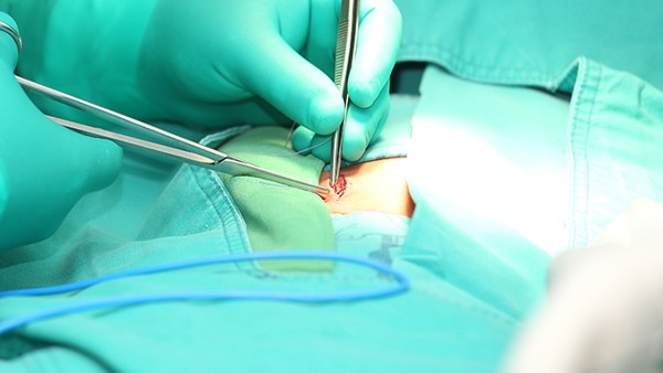 腋下狐臭手術(shù)腋下痛