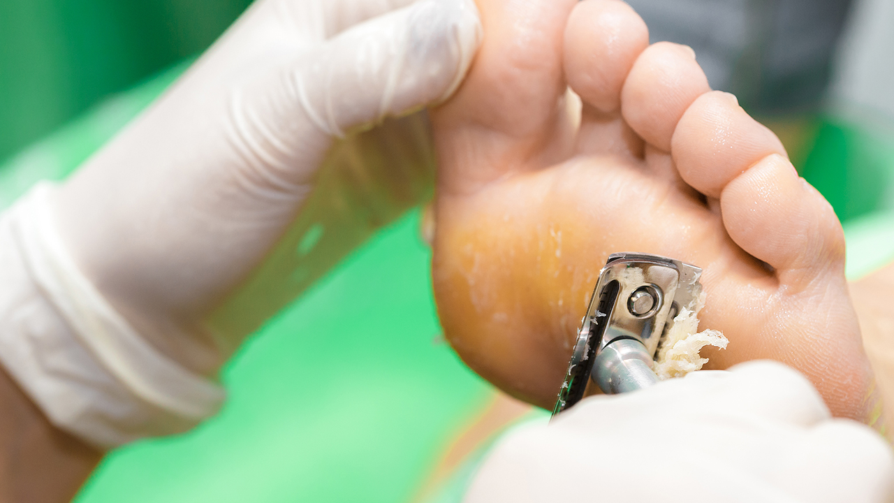 小孩子嚇到會(huì)雞眼嗎