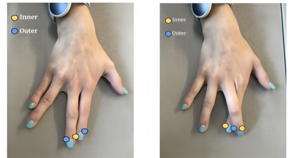 摸到自己有兩個鼻子：其實是“亞里士多德錯覺”