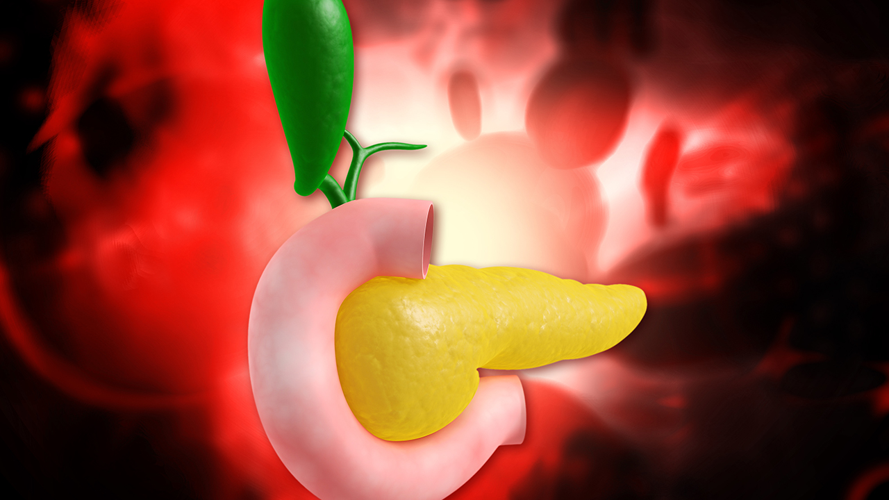 急性膽汁性胰腺炎治療方案