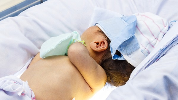 初生兒敗血癥復發(fā)嗎？