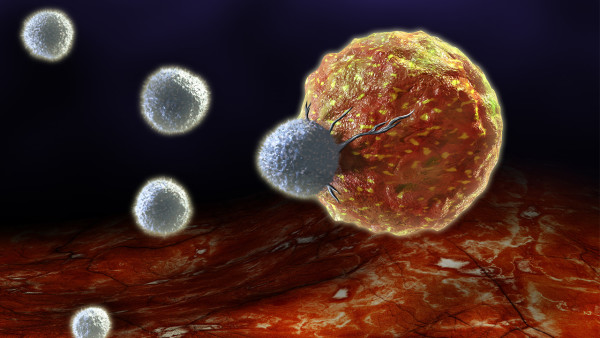 大腿紫斑是艾滋病嗎？