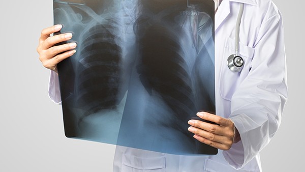 70歲肺大皰自愈最快的方法是什么