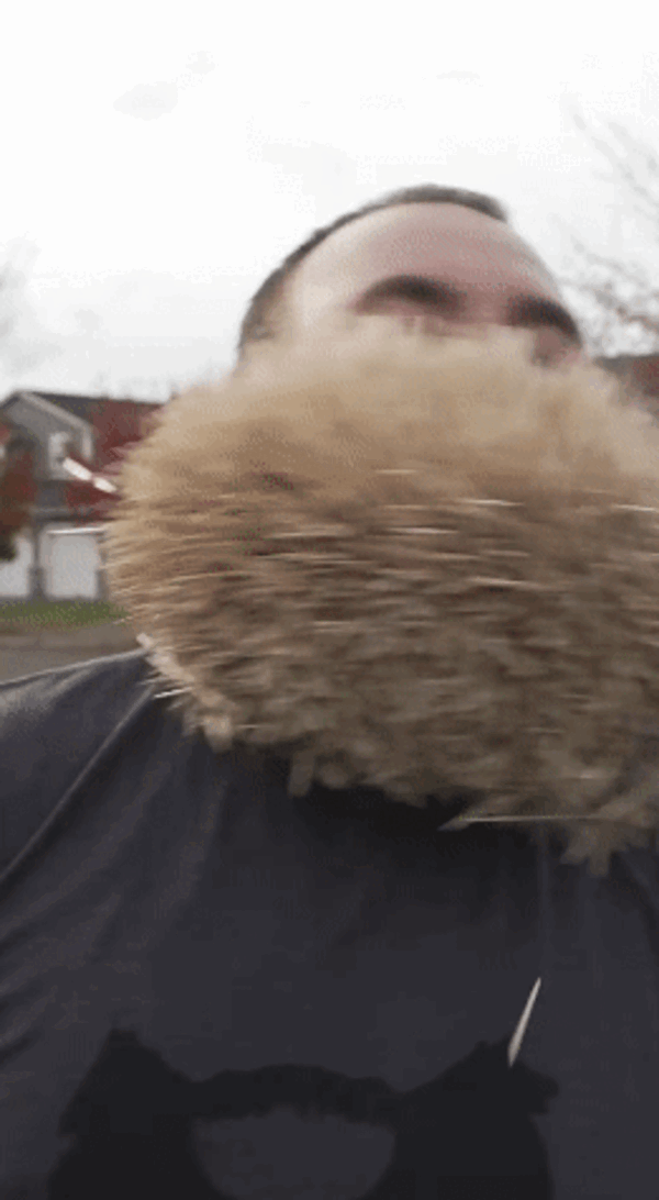 男子胡子插入600根燒烤簽子創(chuàng)吉尼斯世界紀(jì)錄 下巴變刺猬