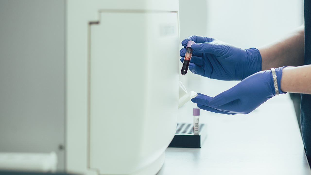 皮肌炎要做哪些檢查