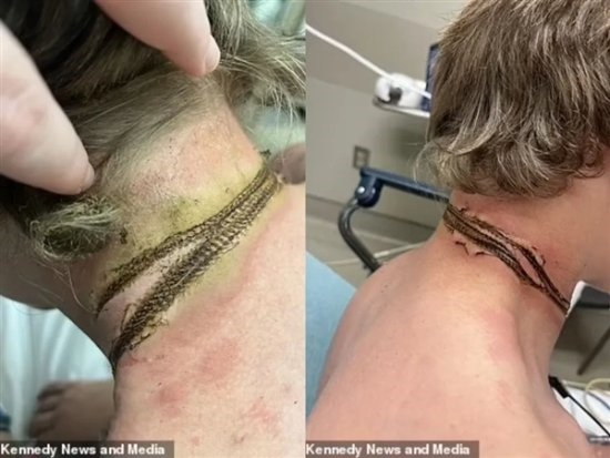 手機(jī)充電意外觸電：小伙差點(diǎn)被金屬十字架項(xiàng)鏈烤熟