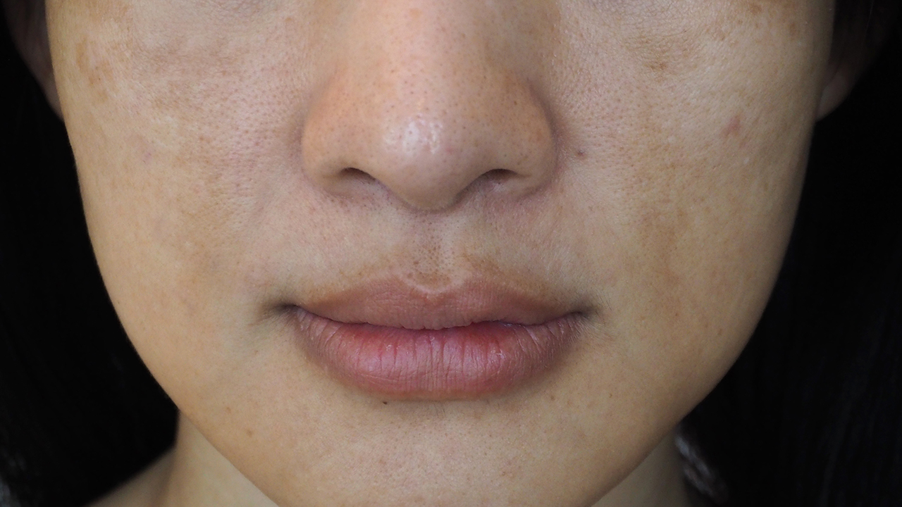 怎么看出來身上有狐臭了