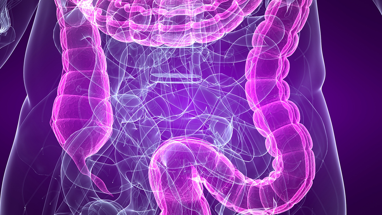 結(jié)腸癌的征兆有哪些