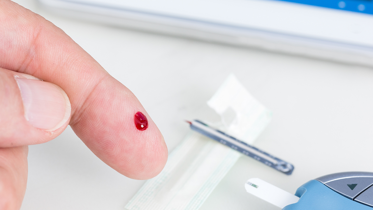 腋窩下有腥味是狐臭嗎嗎