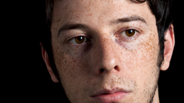 怎么看腋下是不是有狐臭