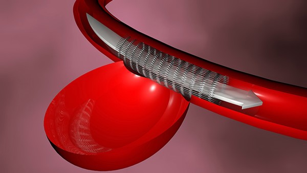 寶寶血小板減少游泳