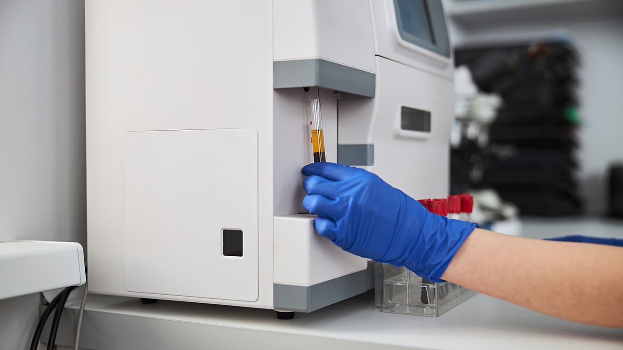 腋下狐臭手術(shù)完傷口發(fā)癢