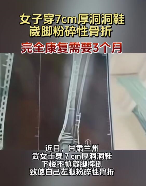 女子穿7cm厚洞洞鞋崴腳粉碎性骨折：完全康復(fù)需3個月