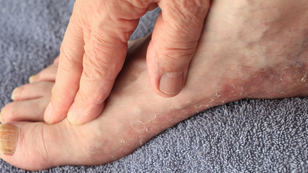 腦萎縮吃什么藥好