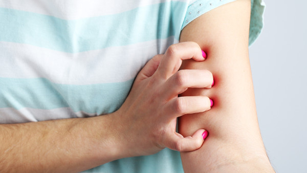 牙齒問題會引起類風(fēng)濕嗎