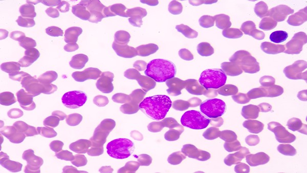 經常抓頭皮會得皮膚癌嗎