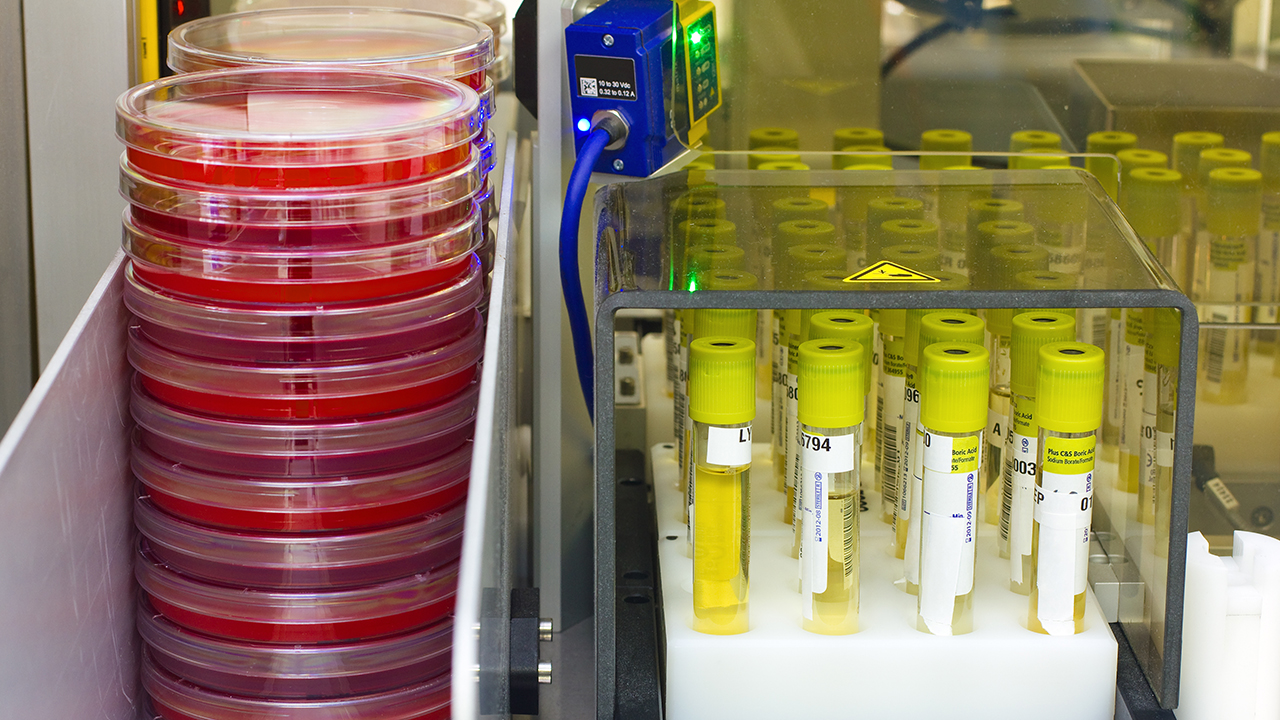 白癜風檢查大概得多少錢