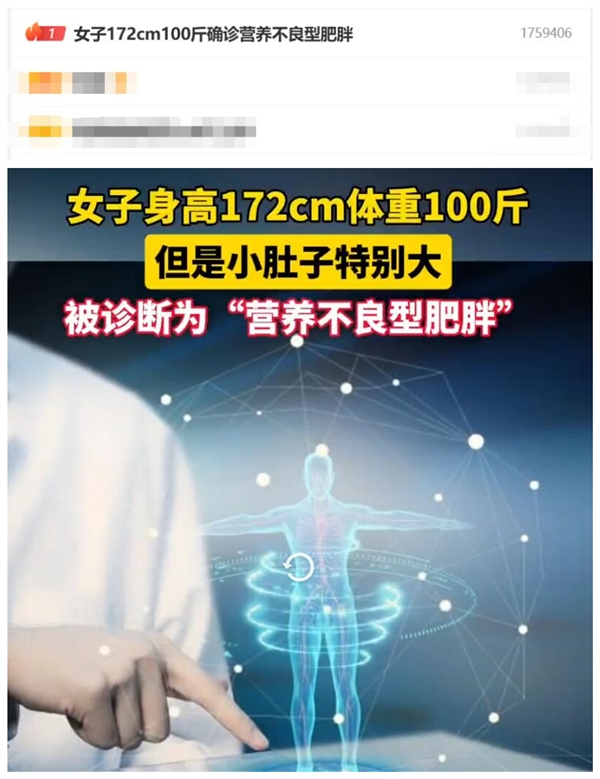 熱搜第一！女子172cm100斤確診營(yíng)養(yǎng)不良型肥胖