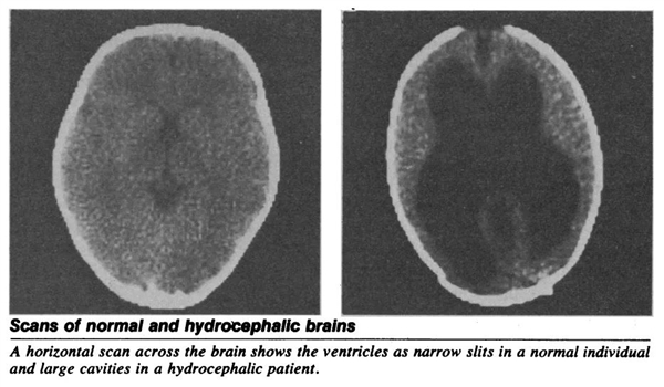 法國一公務(wù)員腦子里都是水：竟然還能正常生活！