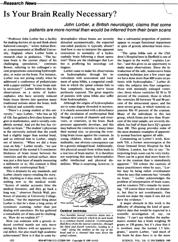 法國一公務(wù)員腦子里都是水：竟然還能正常生活！