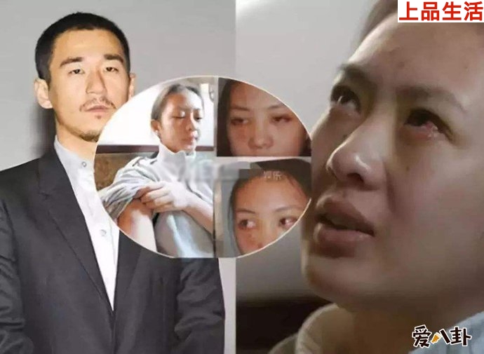 張默為什么怒打女友童瑤如今真相了