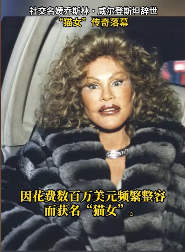整容成貓女的瑞士社交名媛去世：死因初步報告為心臟衰竭